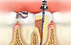 Conservative dentistry and endodontics