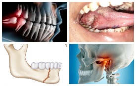 Oral and maxillofacial surgery