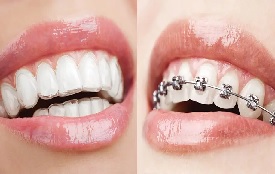 Orthodontics and dentofacial orthopeaedics